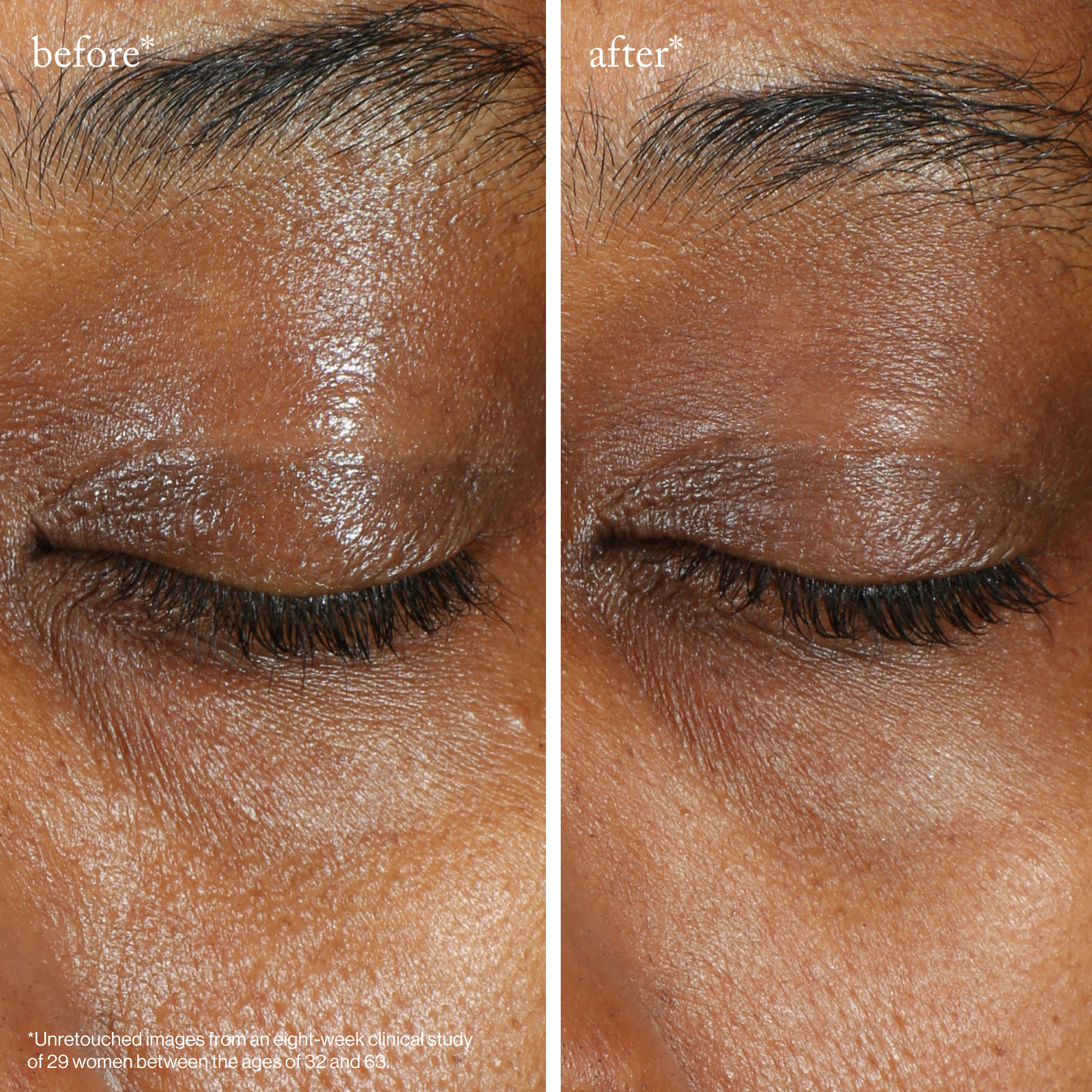 Vita-C Brighting Eye Cream